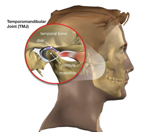 TM joint pain treatment in Nagpur | Temporomandibular Joint Treatment